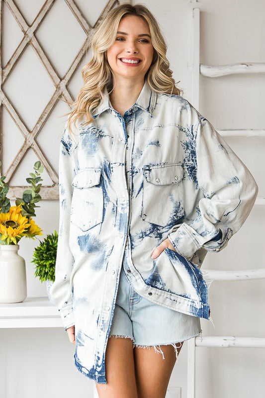 ET30151NE_ACIDWASHEDDENIM_3497248