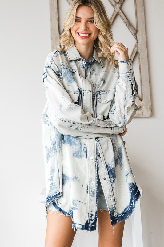 ET30151NE_ACIDWASHEDDENIM_3497247